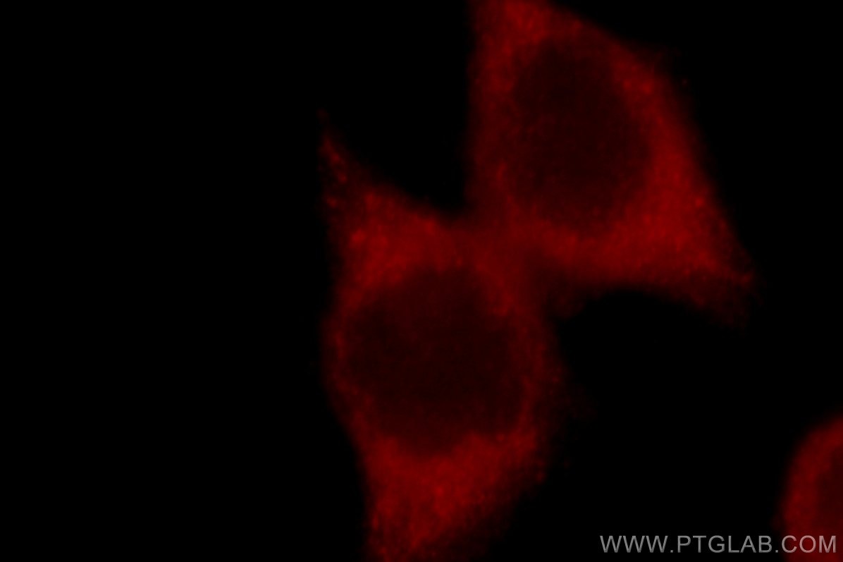 Immunofluorescence (IF) / fluorescent staining of MCF-7 cells using GSK3B Polyclonal antibody (22104-1-AP)