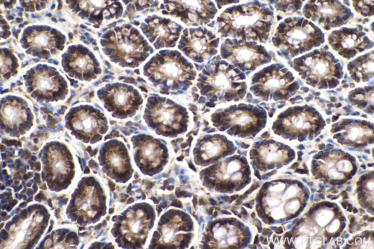 Immunohistochemistry (IHC) staining of rat colon tissue using GSK3B Polyclonal antibody (22104-1-AP)