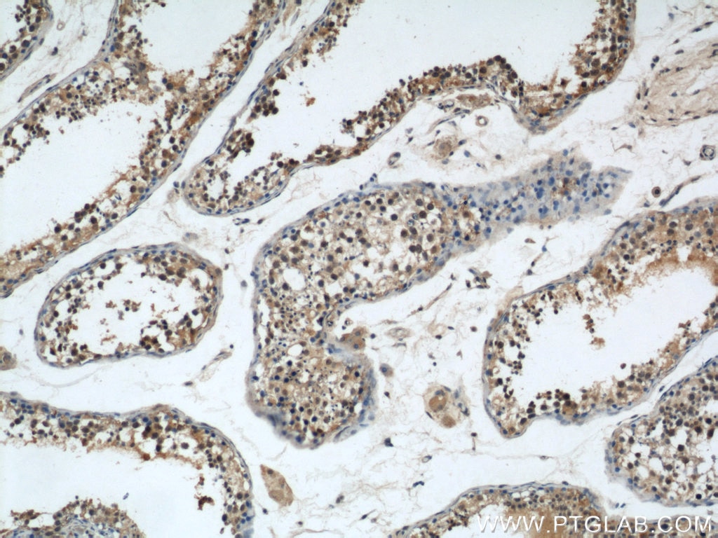 Immunohistochemistry (IHC) staining of human testis tissue using GSK3B Polyclonal antibody (22104-1-AP)