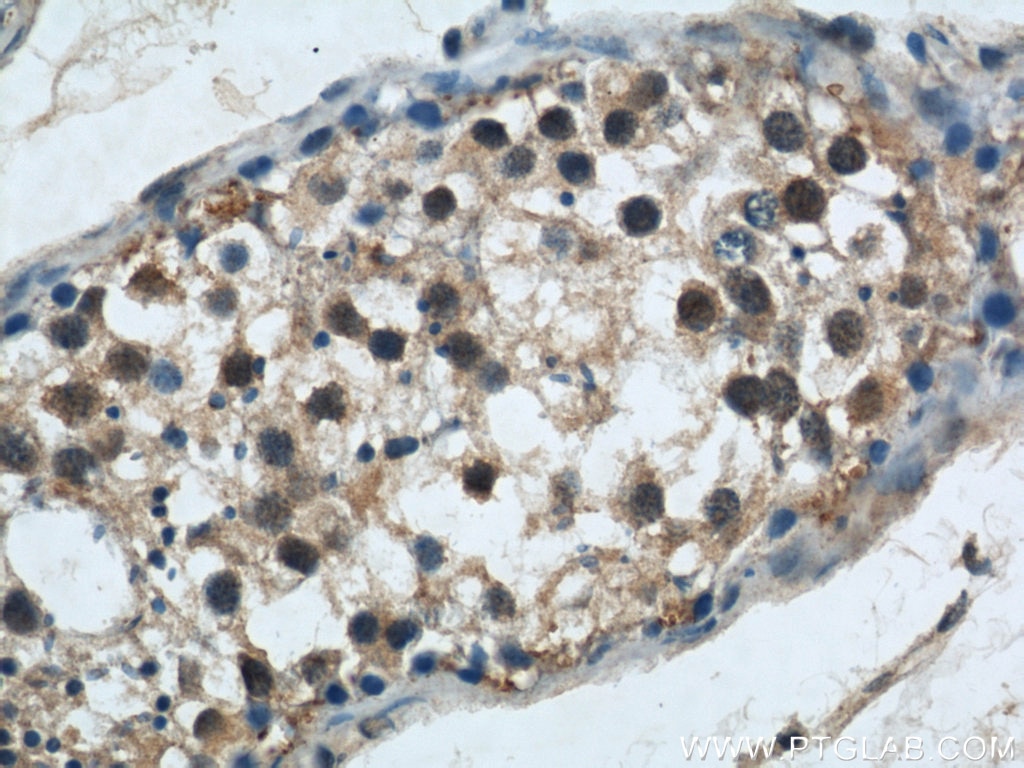 Immunohistochemistry (IHC) staining of human testis tissue using GSK3B Polyclonal antibody (22104-1-AP)