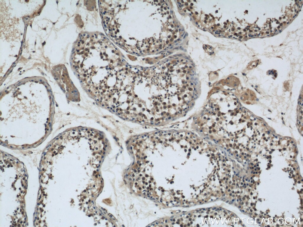 Immunohistochemistry (IHC) staining of human testis tissue using GSK3B Polyclonal antibody (22104-1-AP)