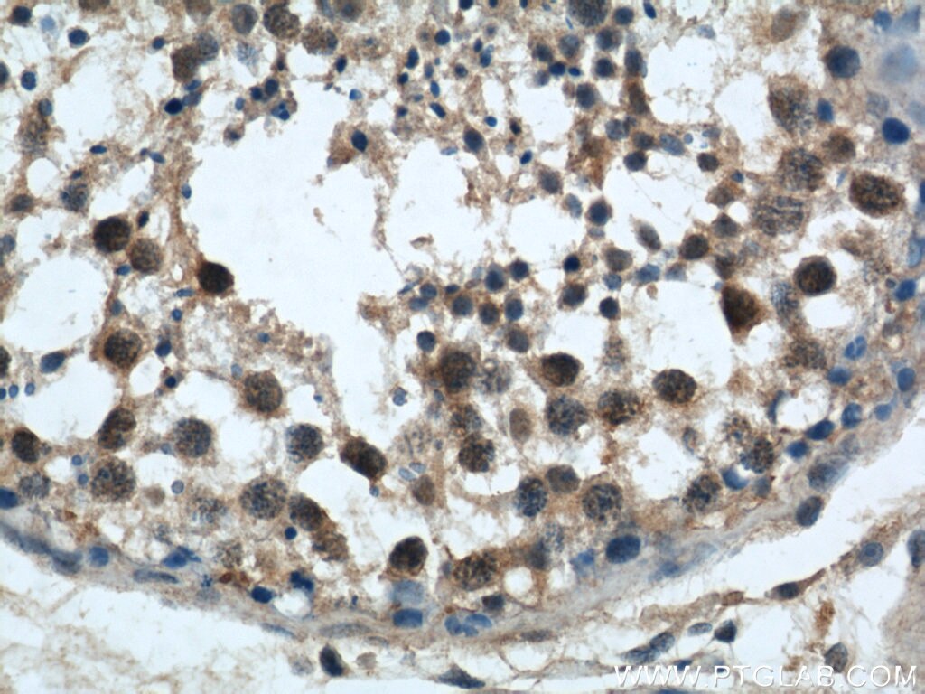 IHC staining of human testis using 22104-1-AP