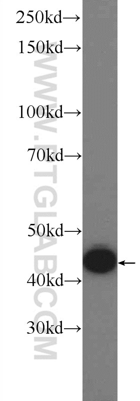 Western Blot (WB) analysis of rat brain tissue using GSK3B Polyclonal antibody (22104-1-AP)