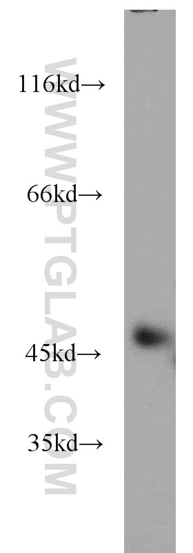 Western Blot (WB) analysis of mouse kidney tissue using GSK3B Polyclonal antibody (22104-1-AP)