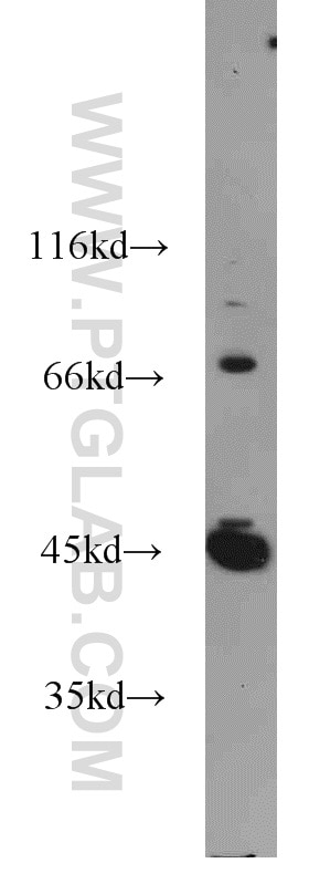 Western Blot (WB) analysis of LNCaP cells using GSK3B Polyclonal antibody (22104-1-AP)