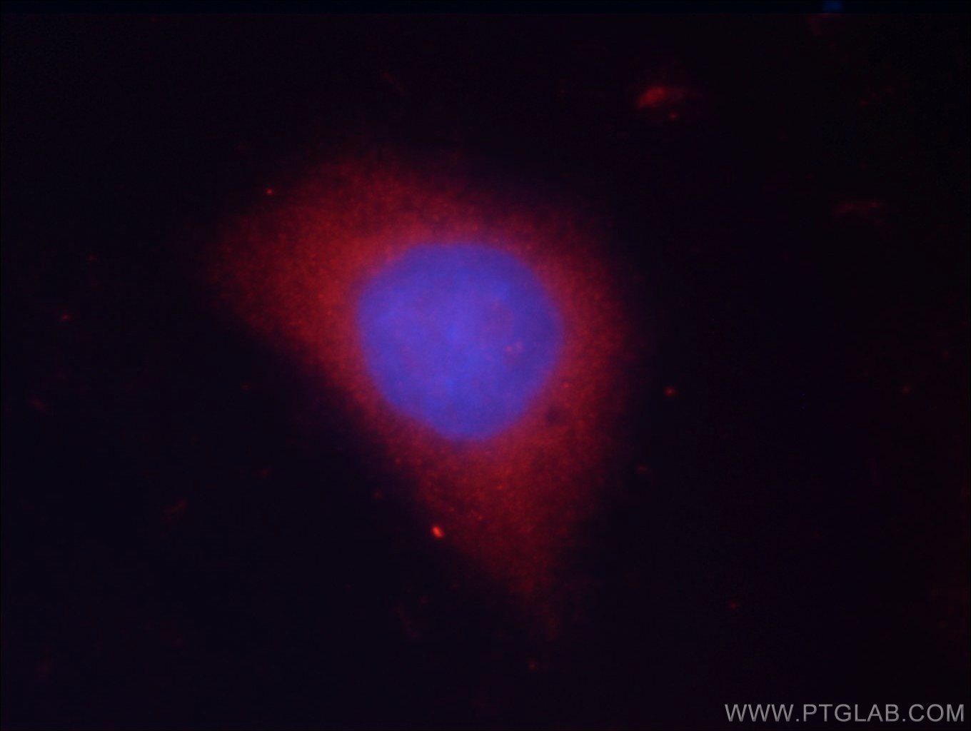 Immunofluorescence (IF) / fluorescent staining of HeLa cells using GSK3B Polyclonal antibody (24198-1-AP)