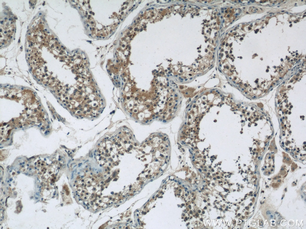 Immunohistochemistry (IHC) staining of human testis tissue using GSK3B Polyclonal antibody (24198-1-AP)