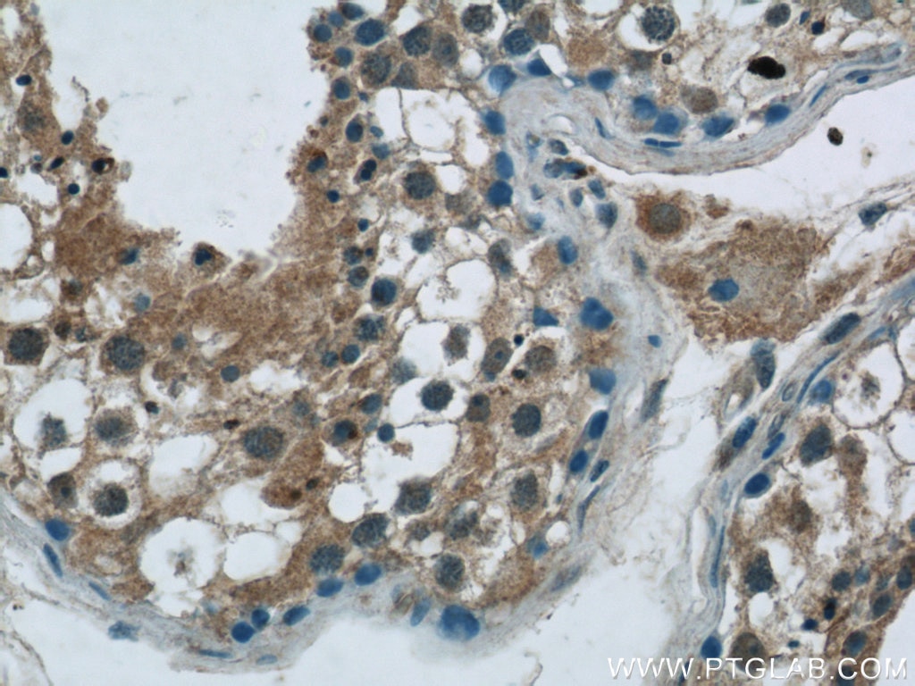 Immunohistochemistry (IHC) staining of human testis tissue using GSK3B Polyclonal antibody (24198-1-AP)