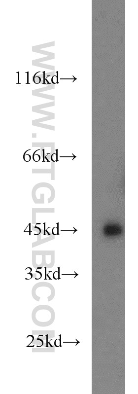 Western Blot (WB) analysis of HeLa cells using GSK3B Polyclonal antibody (24198-1-AP)