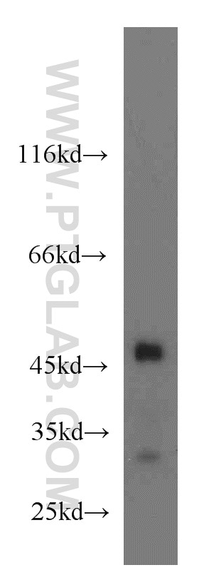 WB analysis of mouse brain using 24198-1-AP