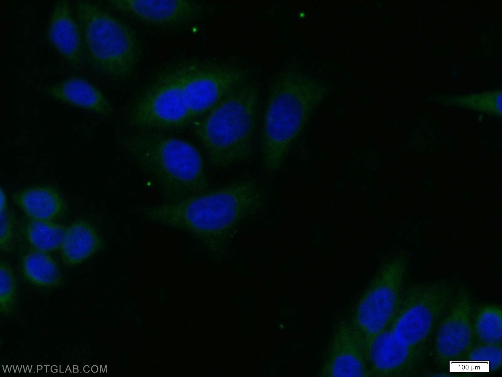 IF Staining of HeLa using 51065-1-AP