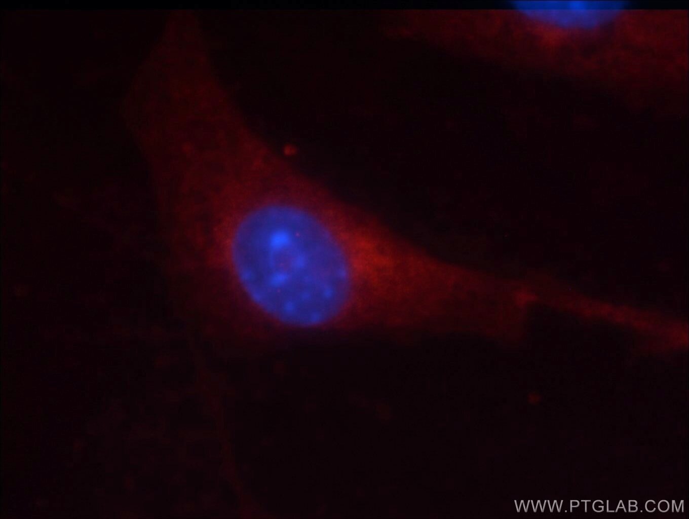 IF Staining of NIH/3T3 using 51065-1-AP