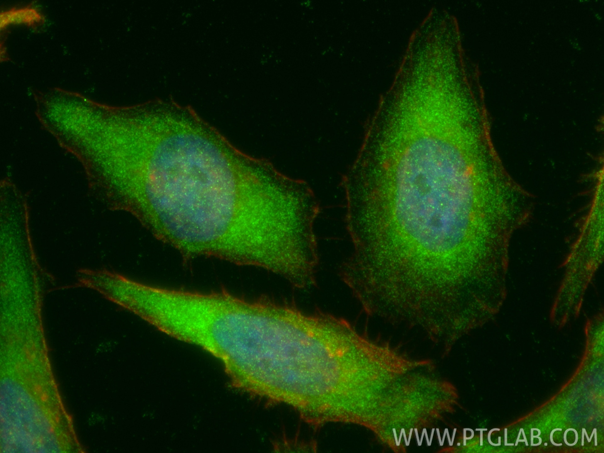 IF Staining of HeLa using 51065-1-AP Immunofluorescence (IF) / fluorescent staining of HeLa cells using GSK3B Polyclonal antibody (51065-1-AP)