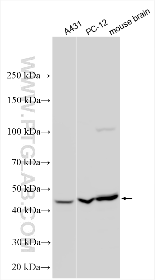 WB analysis using 51065-1-AP Western Blot (WB) analysis of various lysates using GSK3B Polyclonal antibody (51065-1-AP)