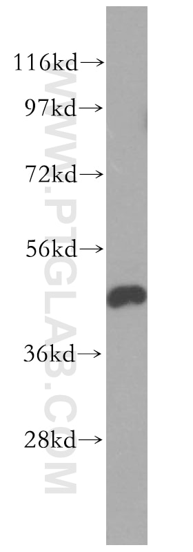 Western Blot (WB) analysis of HEK-293 cells using GSK3B Polyclonal antibody (51065-1-AP)
