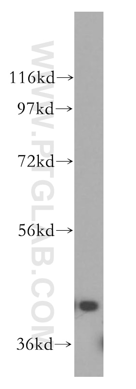 Western Blot (WB) analysis of HeLa cells using GSK3B Polyclonal antibody (51065-1-AP)