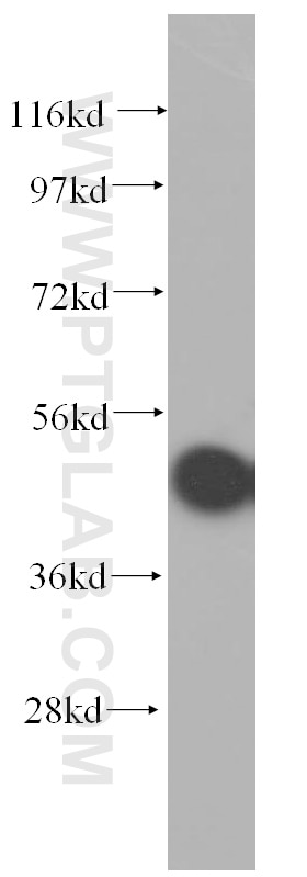 GSK3B