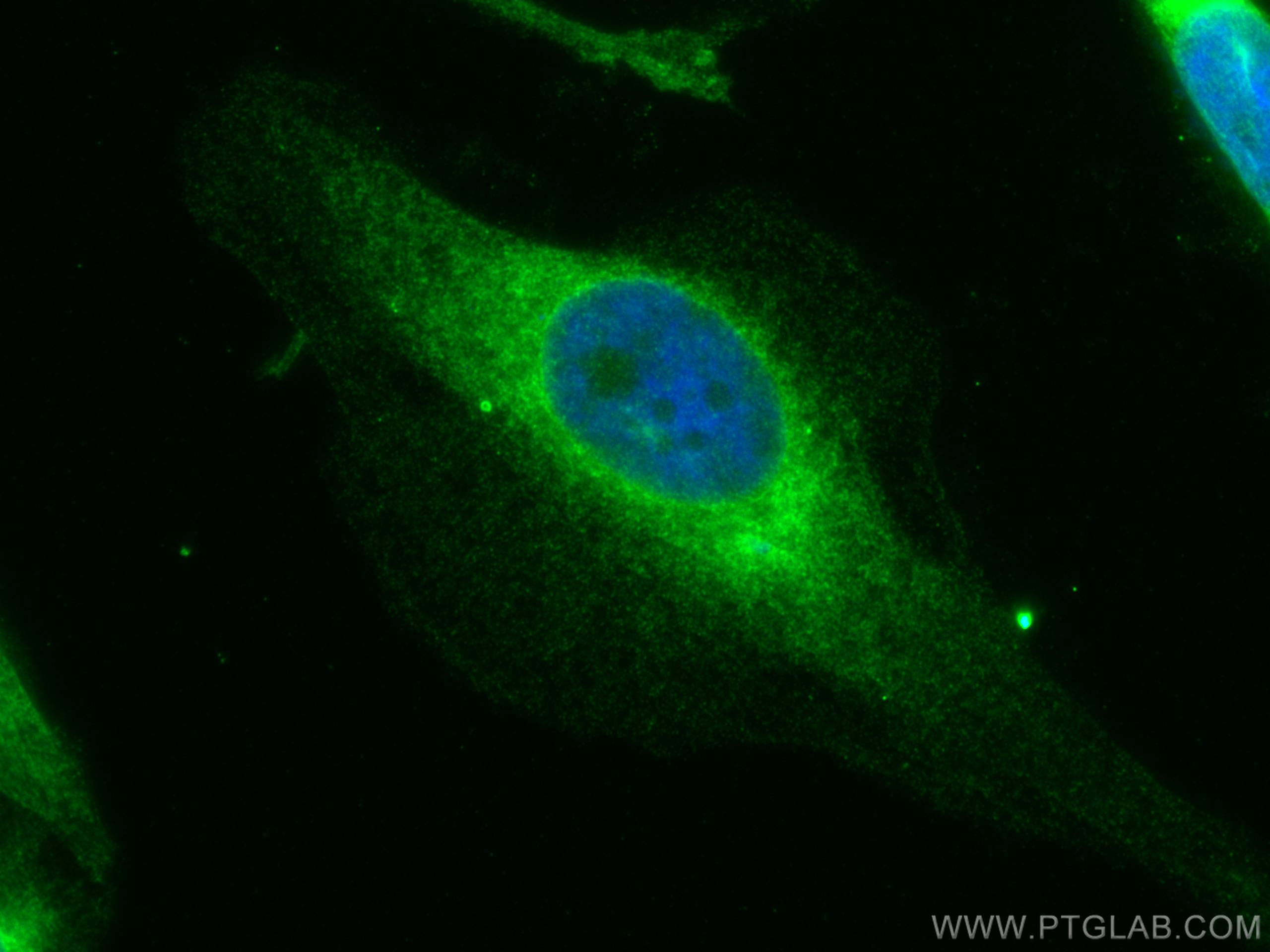 Immunofluorescence (IF) / fluorescent staining of HeLa cells using GSK3B Monoclonal antibody (67329-1-Ig)