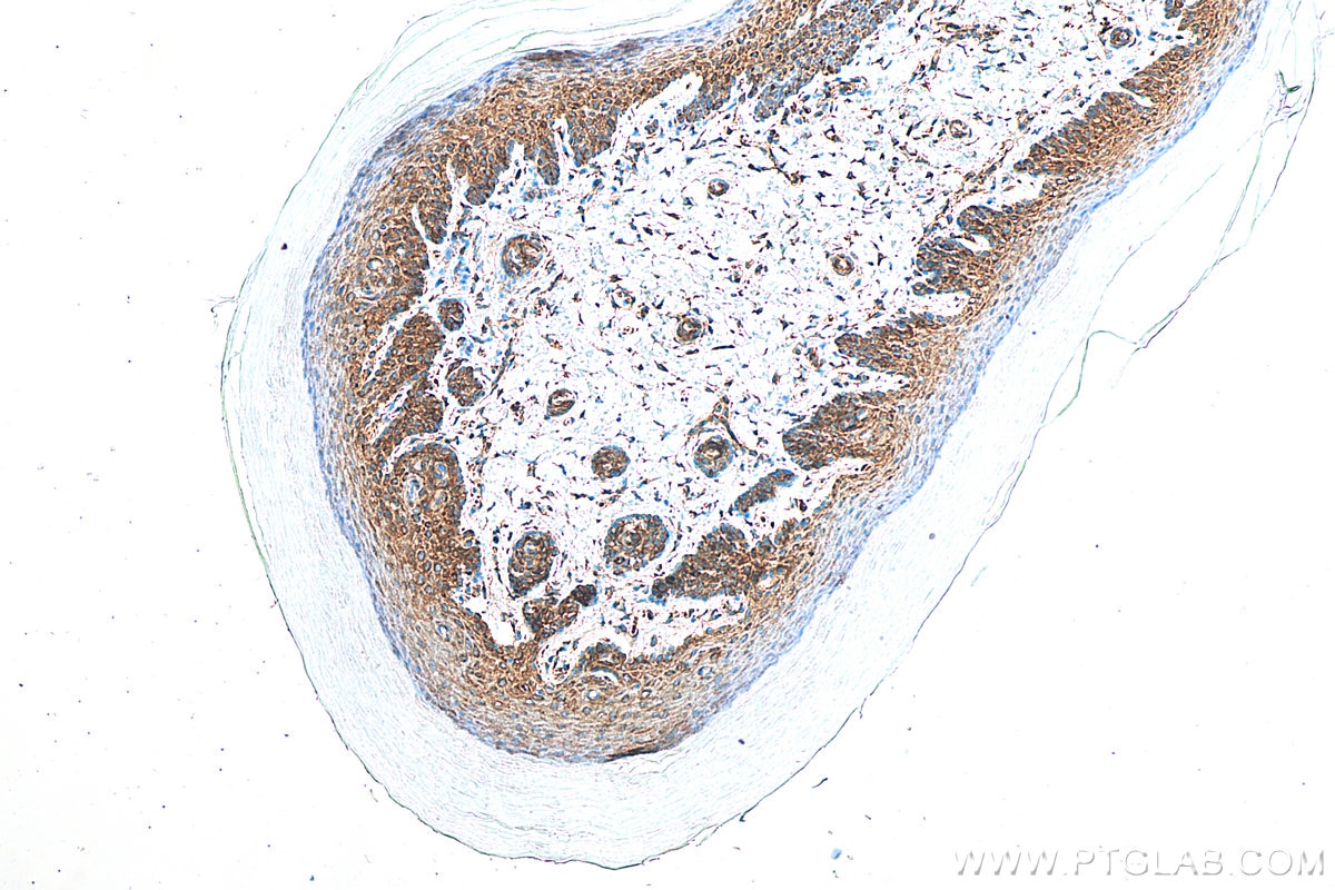 Immunohistochemistry (IHC) staining of mouse skin tissue using GSK3B Recombinant antibody (82061-1-RR)