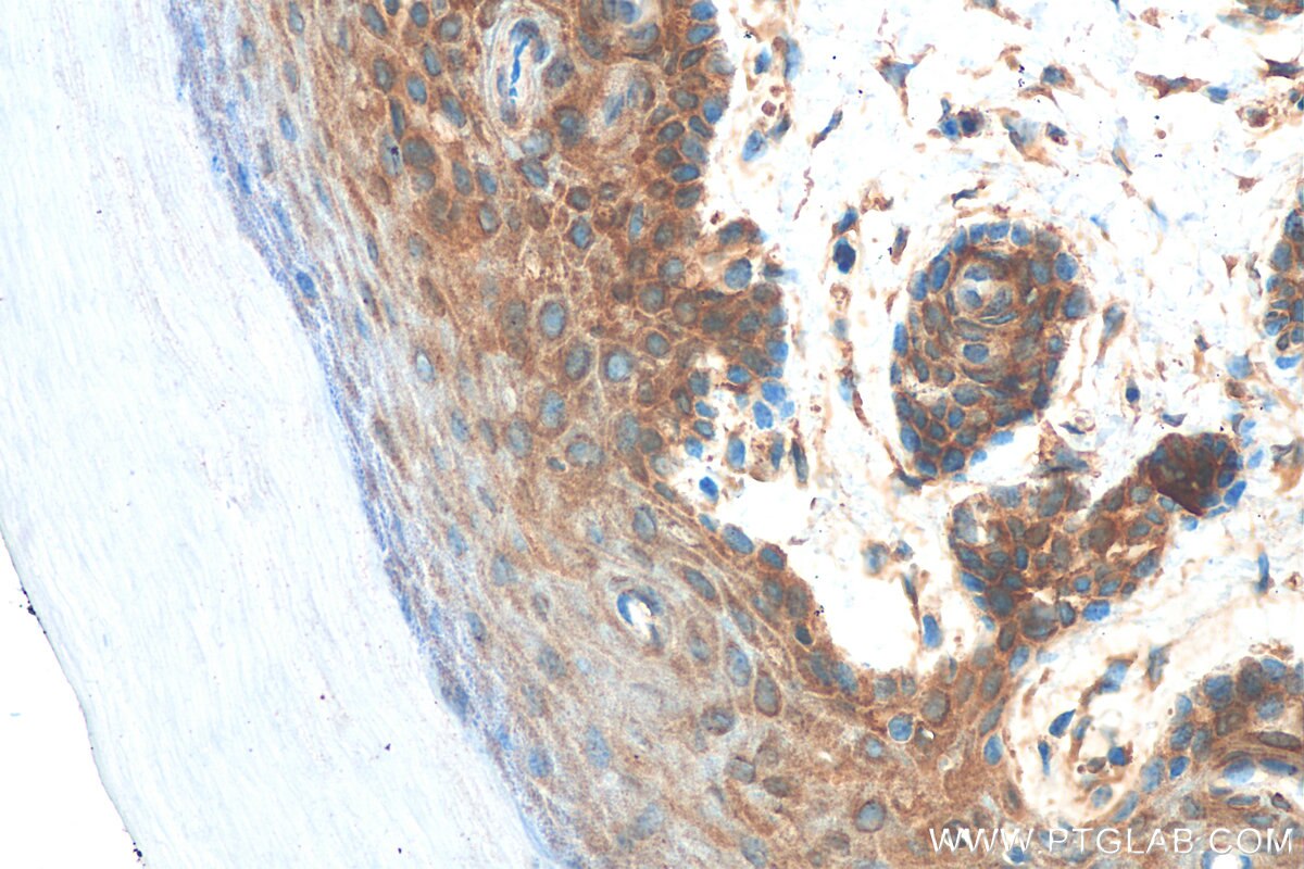 Immunohistochemistry (IHC) staining of mouse skin tissue using GSK3B Recombinant antibody (82061-1-RR)