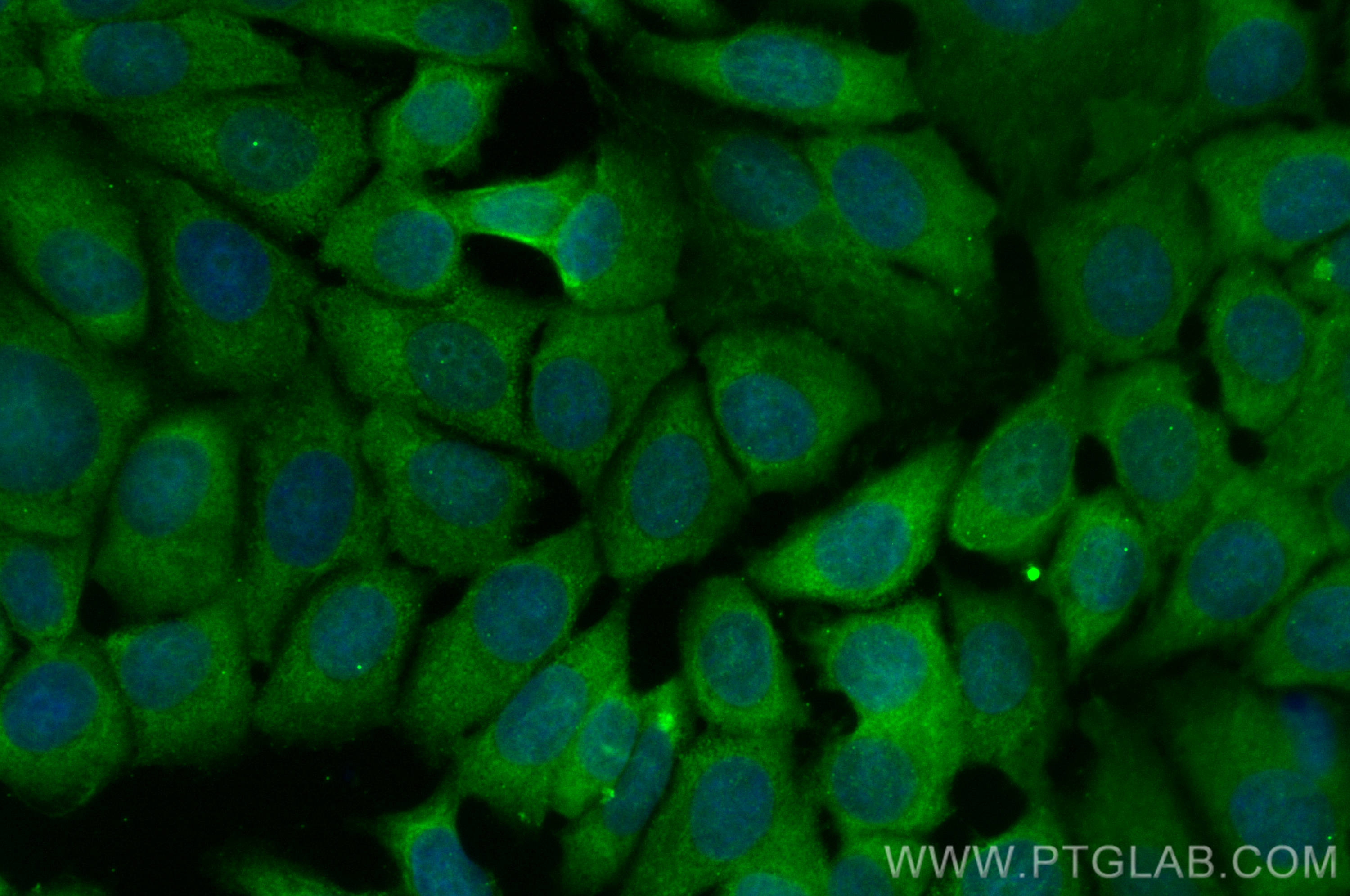 Immunofluorescence (IF) / fluorescent staining of MCF-7 cells using CoraLite® Plus 488-conjugated GSK3B Polyclonal ant (CL488-22104)