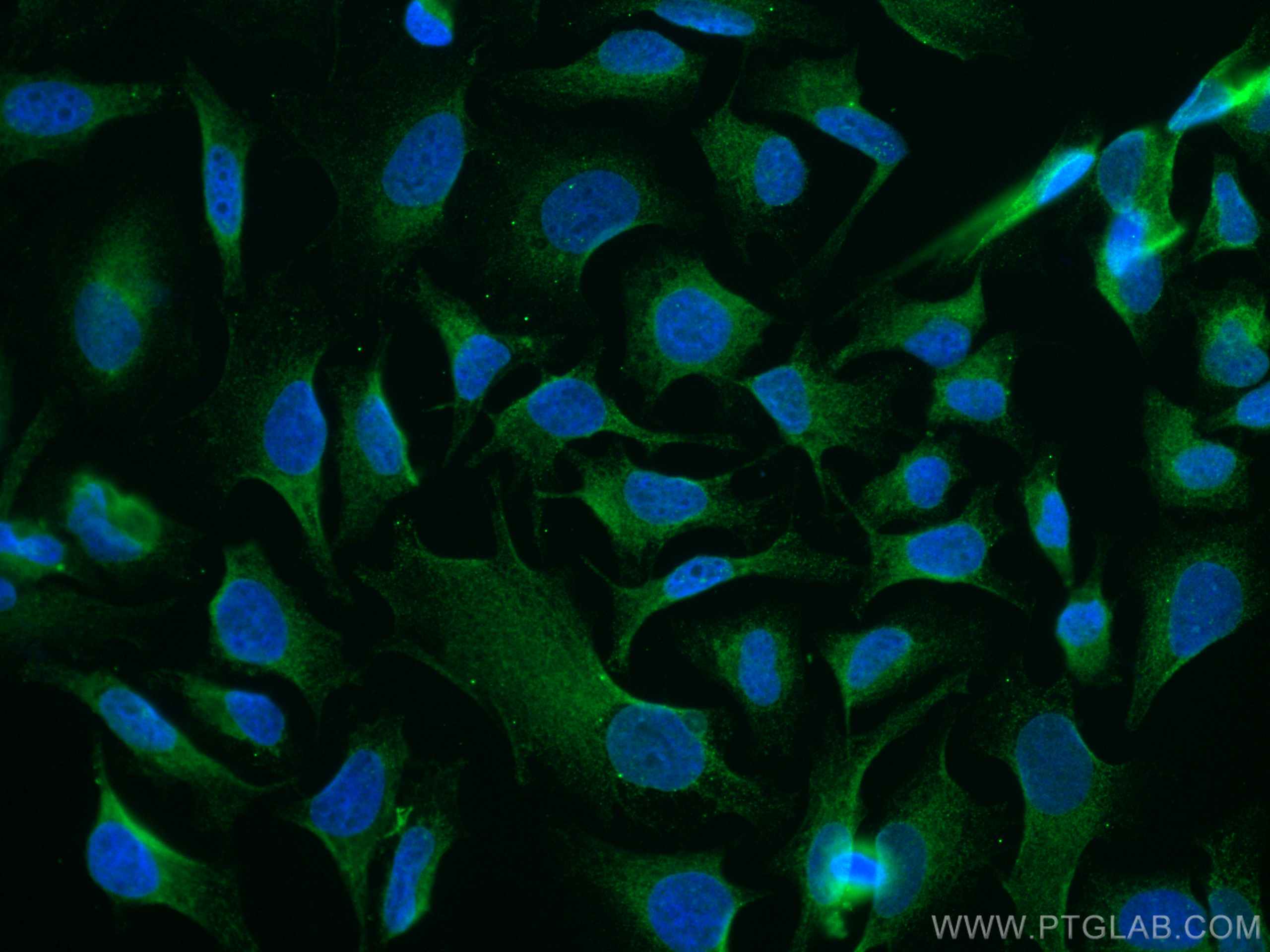 Immunofluorescence (IF) / fluorescent staining of HeLa cells using CoraLite® Plus 488-conjugated GSK3B Monoclonal ant (CL488-67329)