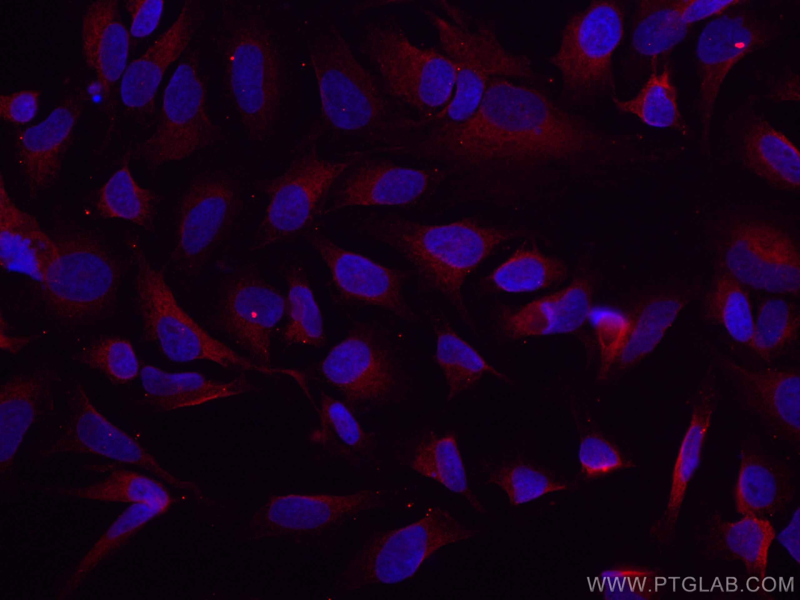 Immunofluorescence (IF) / fluorescent staining of HeLa cells using CoraLite®594-conjugated GSK3B Monoclonal antibody (CL594-67329)
