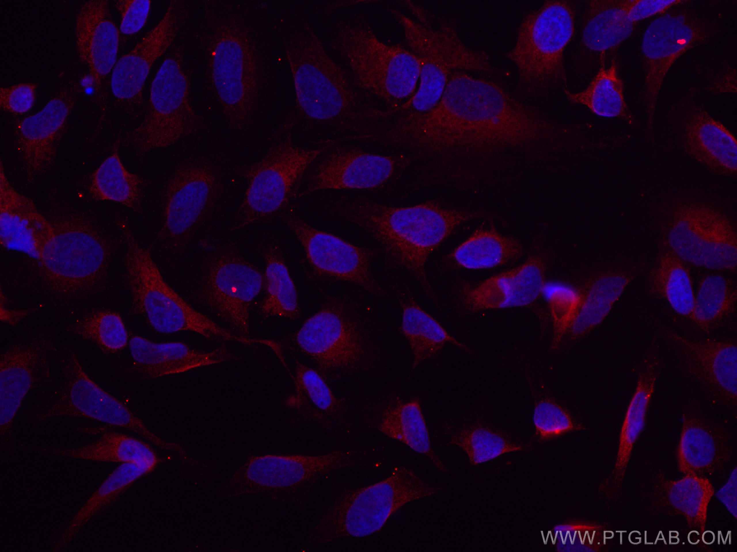 IF Staining of HeLa using CL594-67329