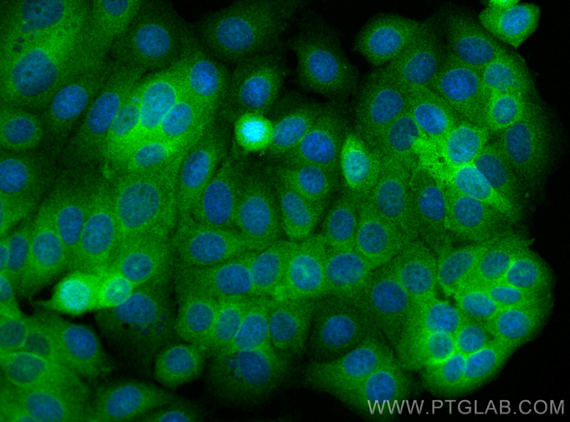 Immunofluorescence (IF) / fluorescent staining of MCF-7 cells using Multi-rAb® GSK3B Multi-Recombinant antibody (RMX00019)