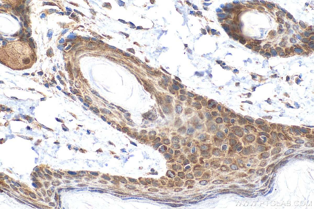 Immunohistochemistry (IHC) staining of mouse skin tissue using Multi-rAb® GSK3B Multi-Recombinant antibody (RMX00019)