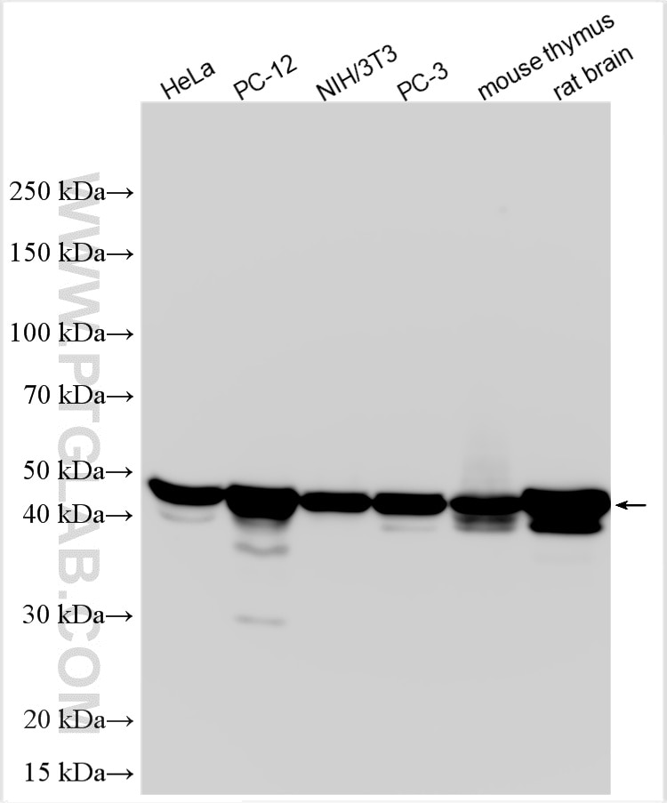 Western Blot (WB) analysis of various lysates using Multi-rAb® GSK3B Multi-Recombinant antibody (RMX00019)