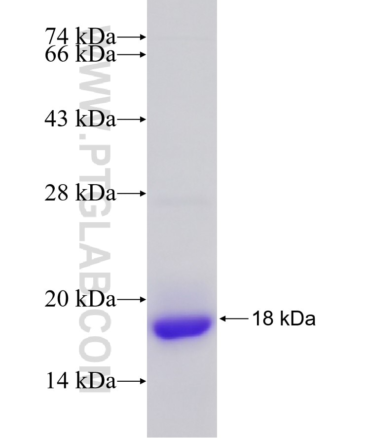 GSK3B fusion protein Ag17320 SDS-PAGE