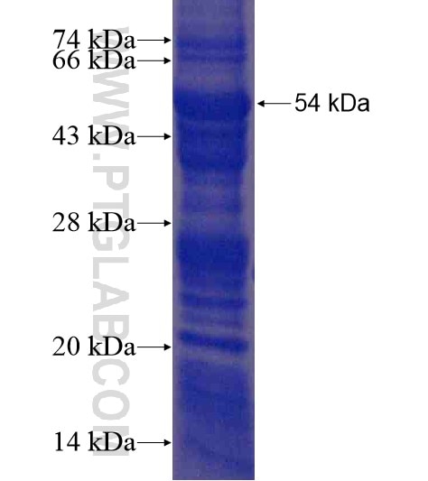 GSK3B fusion protein Ag21438 SDS-PAGE