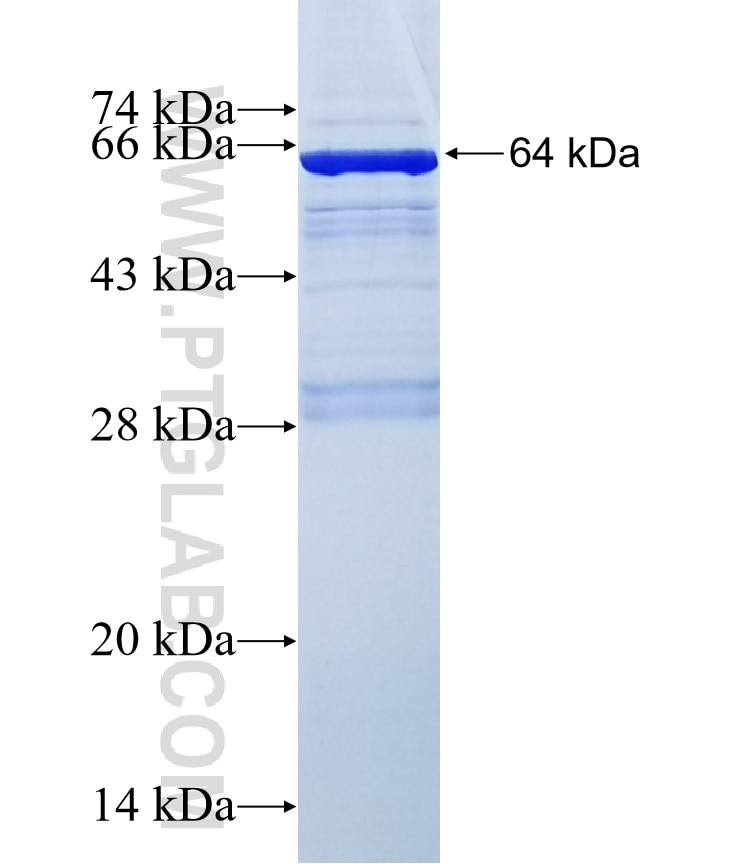 GSK3B fusion protein Ag7101 SDS-PAGE