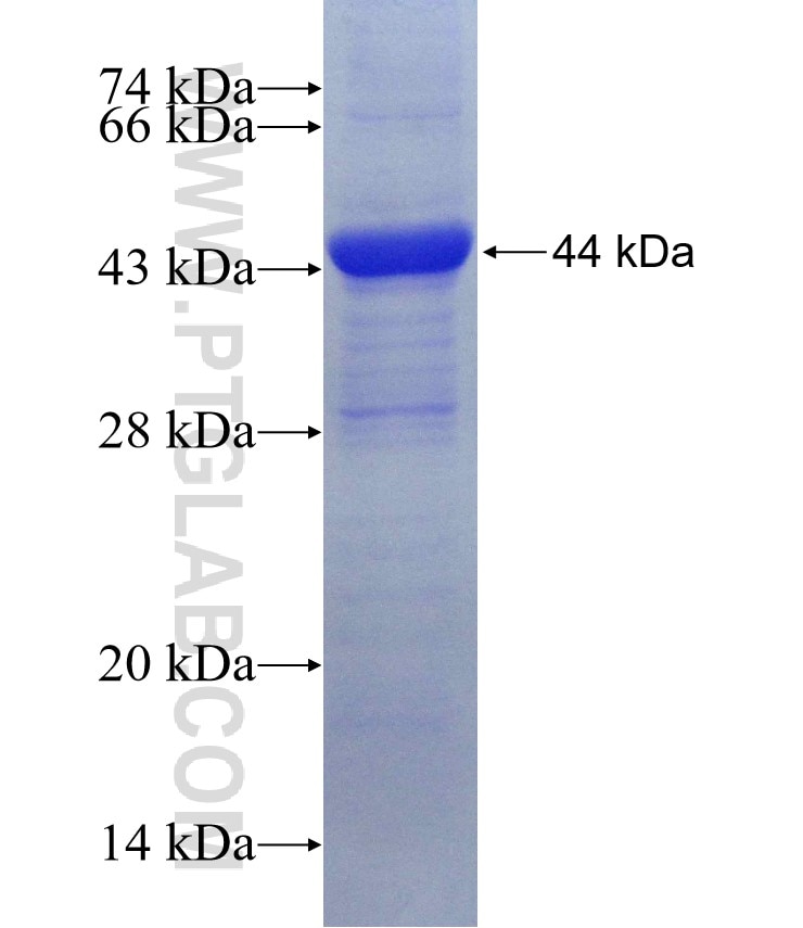 GSK3B fusion protein Ag7572 SDS-PAGE