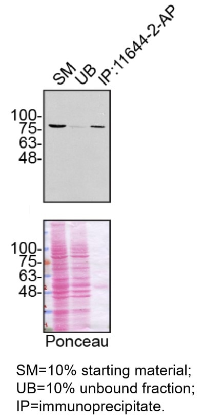 Immunoprecipitation (IP) experiment of U2OS cells using Gelsolin Polyclonal antibody (11644-2-AP)
