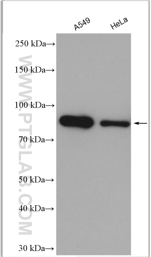 Western Blot (WB) analysis of various lysates using Gelsolin Polyclonal antibody (11644-2-AP)