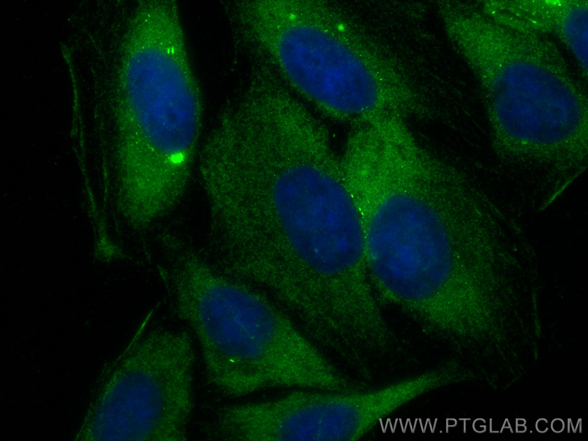 Immunofluorescence (IF) / fluorescent staining of HepG2 cells using GSNOR,ADH5 Polyclonal antibody (11051-1-AP)