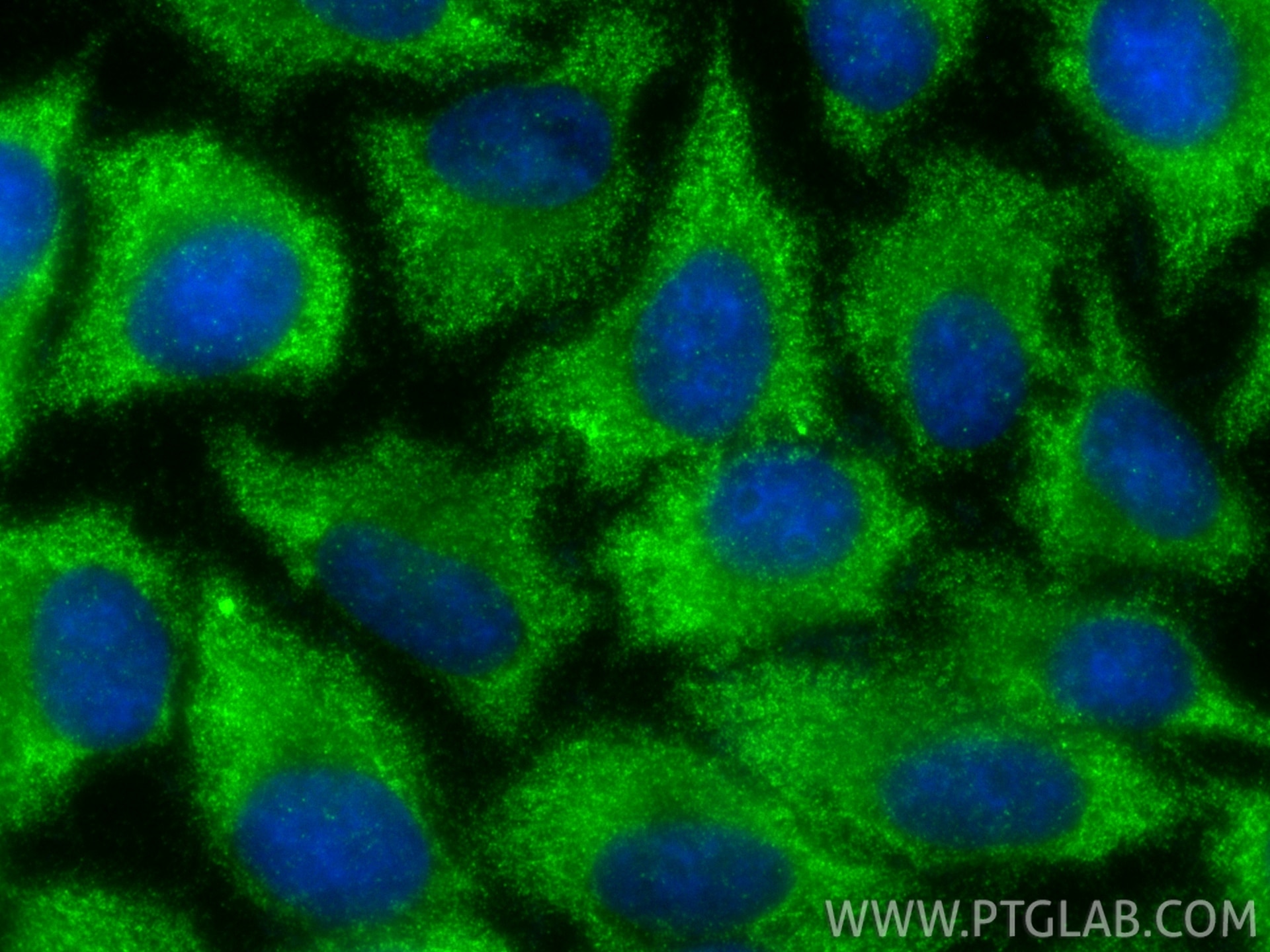 Immunofluorescence (IF) / fluorescent staining of HepG2 cells using GSNOR,ADH5 Polyclonal antibody (11051-1-AP)