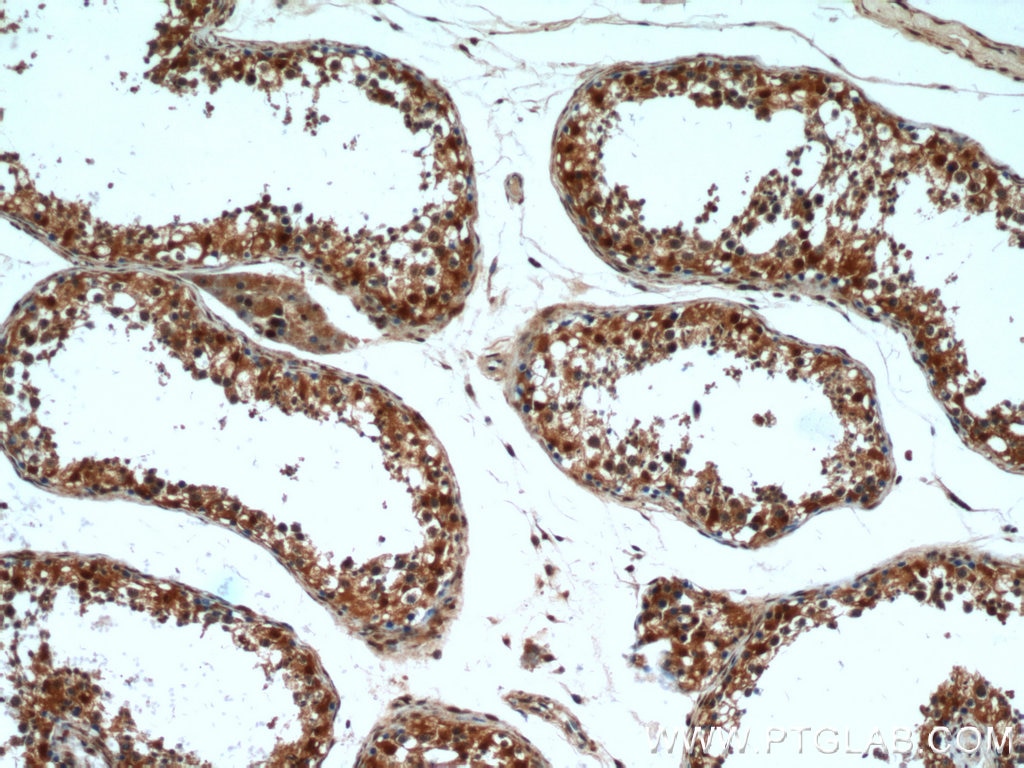 Immunohistochemistry (IHC) staining of human testis tissue using GSNOR,ADH5 Polyclonal antibody (16379-1-AP)