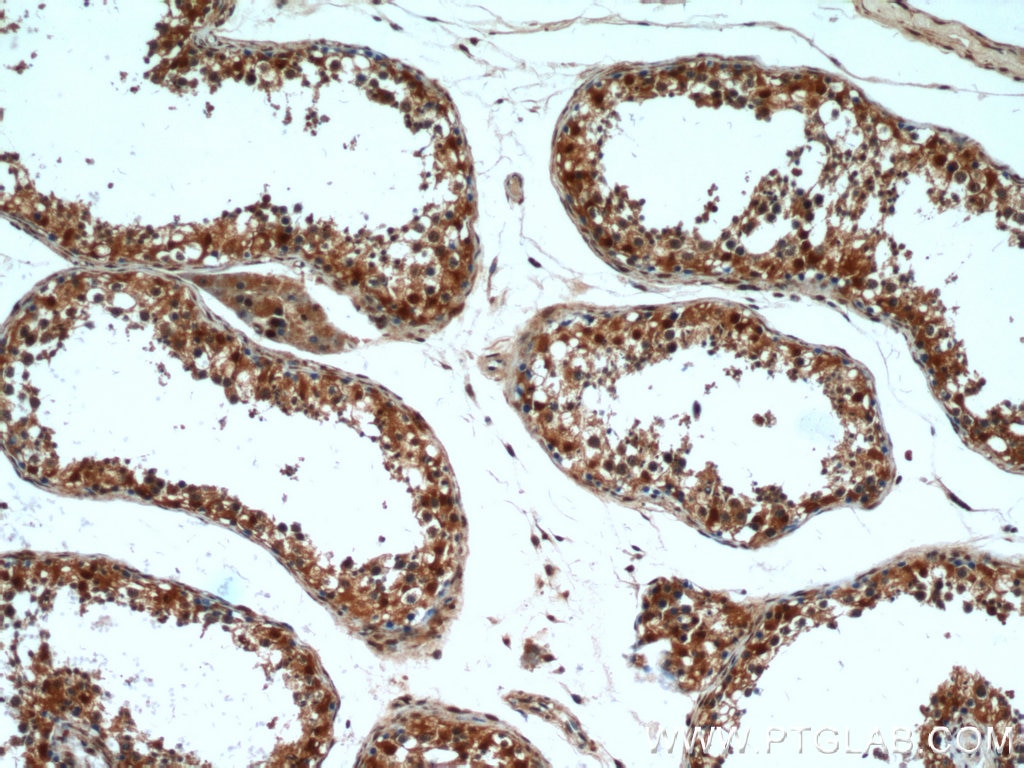 IHC staining of human testis using 16379-1-AP