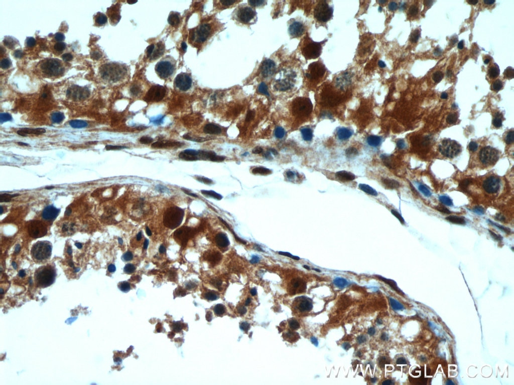 Immunohistochemistry (IHC) staining of human testis tissue using GSNOR,ADH5 Polyclonal antibody (16379-1-AP)