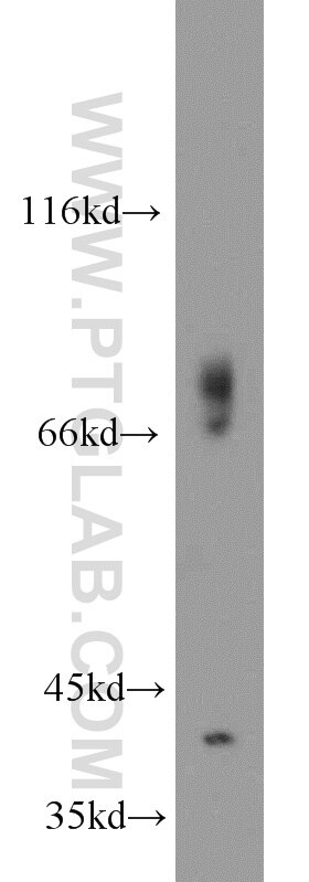 WB analysis of mouse heart using 16379-1-AP