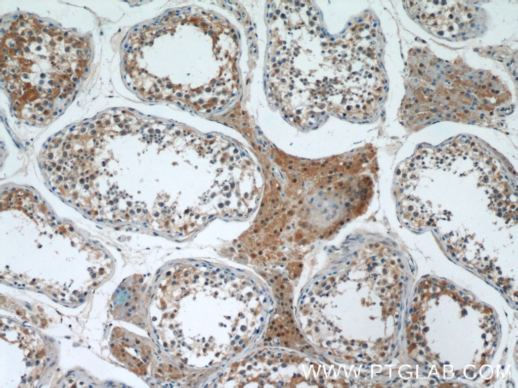 Immunohistochemistry (IHC) staining of human testis tissue using GSNOR,ADH5 Monoclonal antibody (66193-1-Ig)