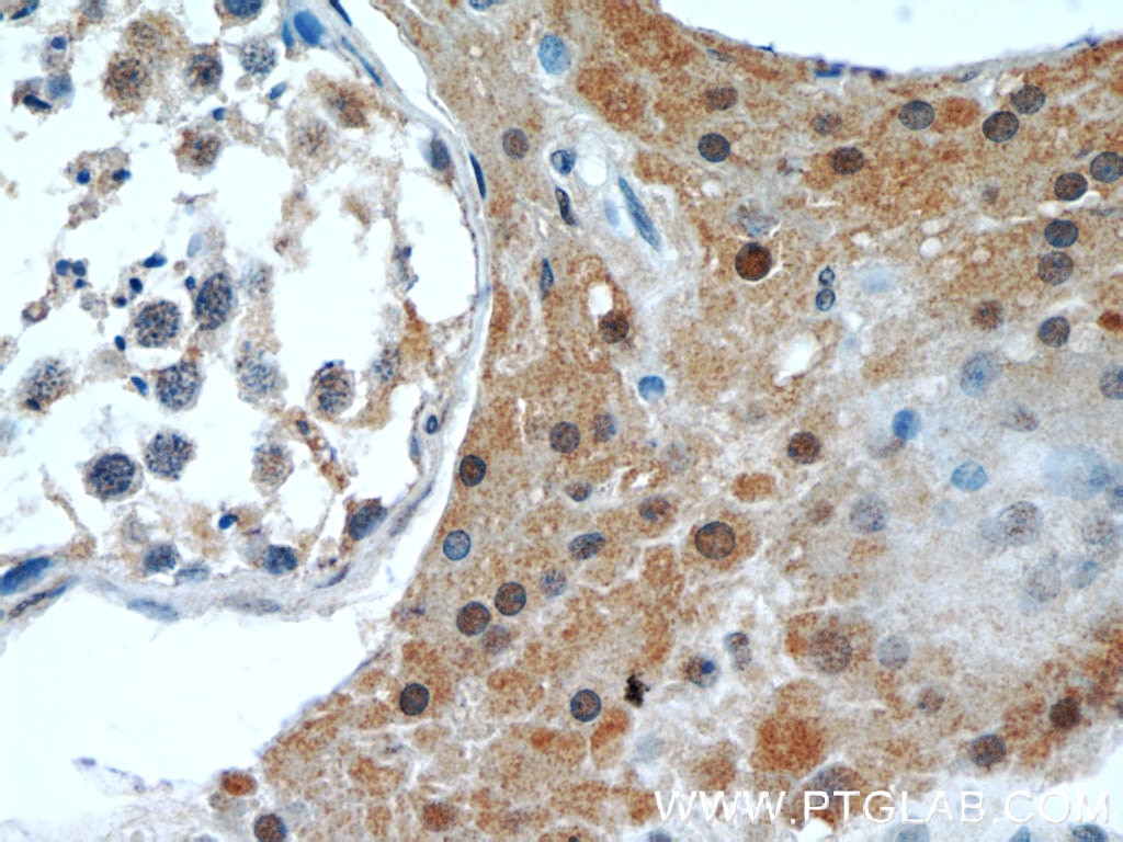 Immunohistochemistry (IHC) staining of human testis tissue using GSNOR,ADH5 Monoclonal antibody (66193-1-Ig)