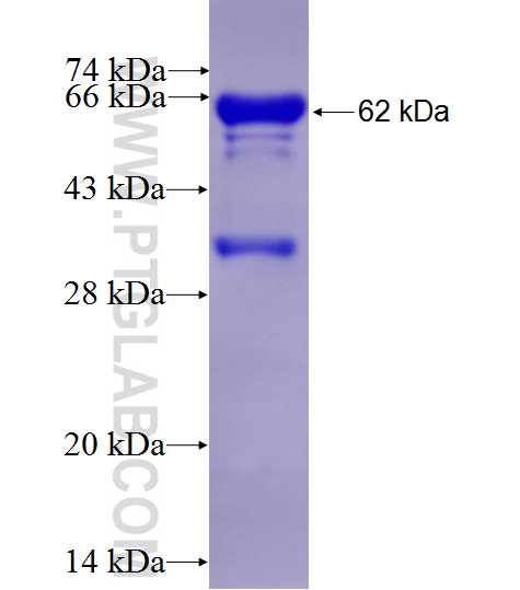 GSNOR,ADH5 fusion protein Ag9360 SDS-PAGE