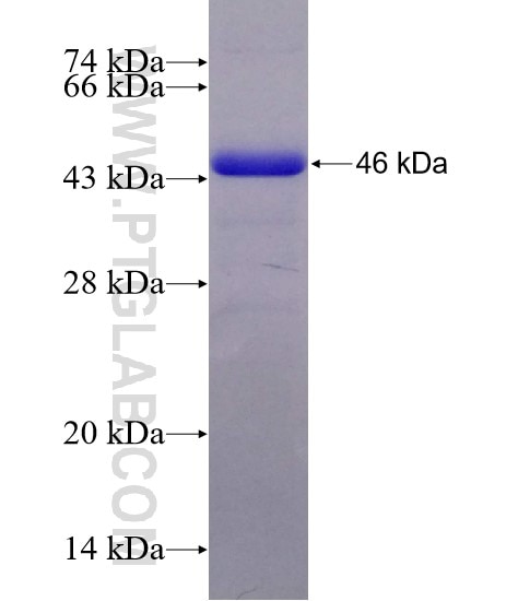 GSNOR,ADH5 fusion protein Ag9511 SDS-PAGE