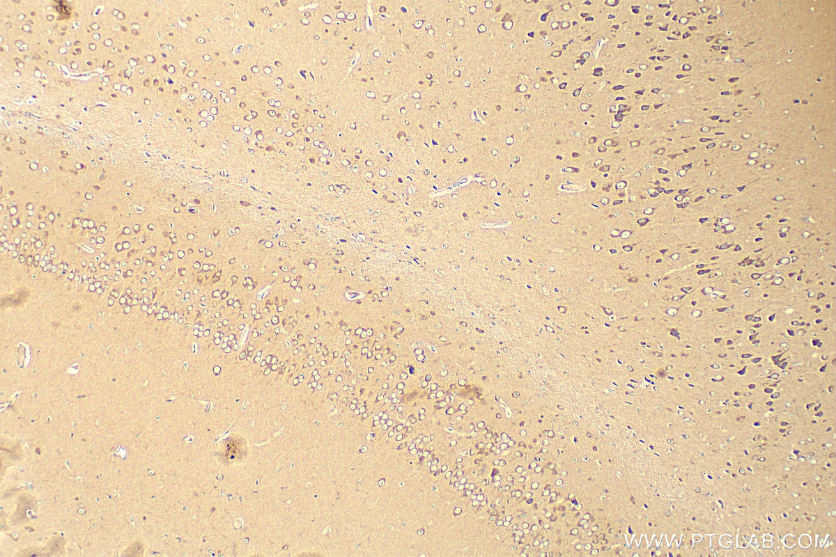 Immunohistochemistry (IHC) staining of mouse brain tissue using eRF3a/GSPT1 Polyclonal antibody (10763-1-AP)