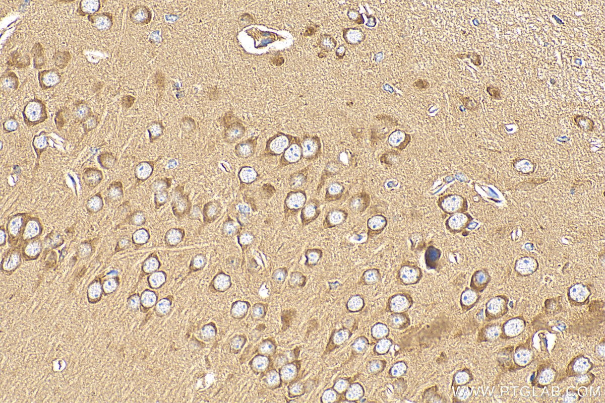 Immunohistochemistry (IHC) staining of mouse brain tissue using eRF3a/GSPT1 Polyclonal antibody (10763-1-AP)