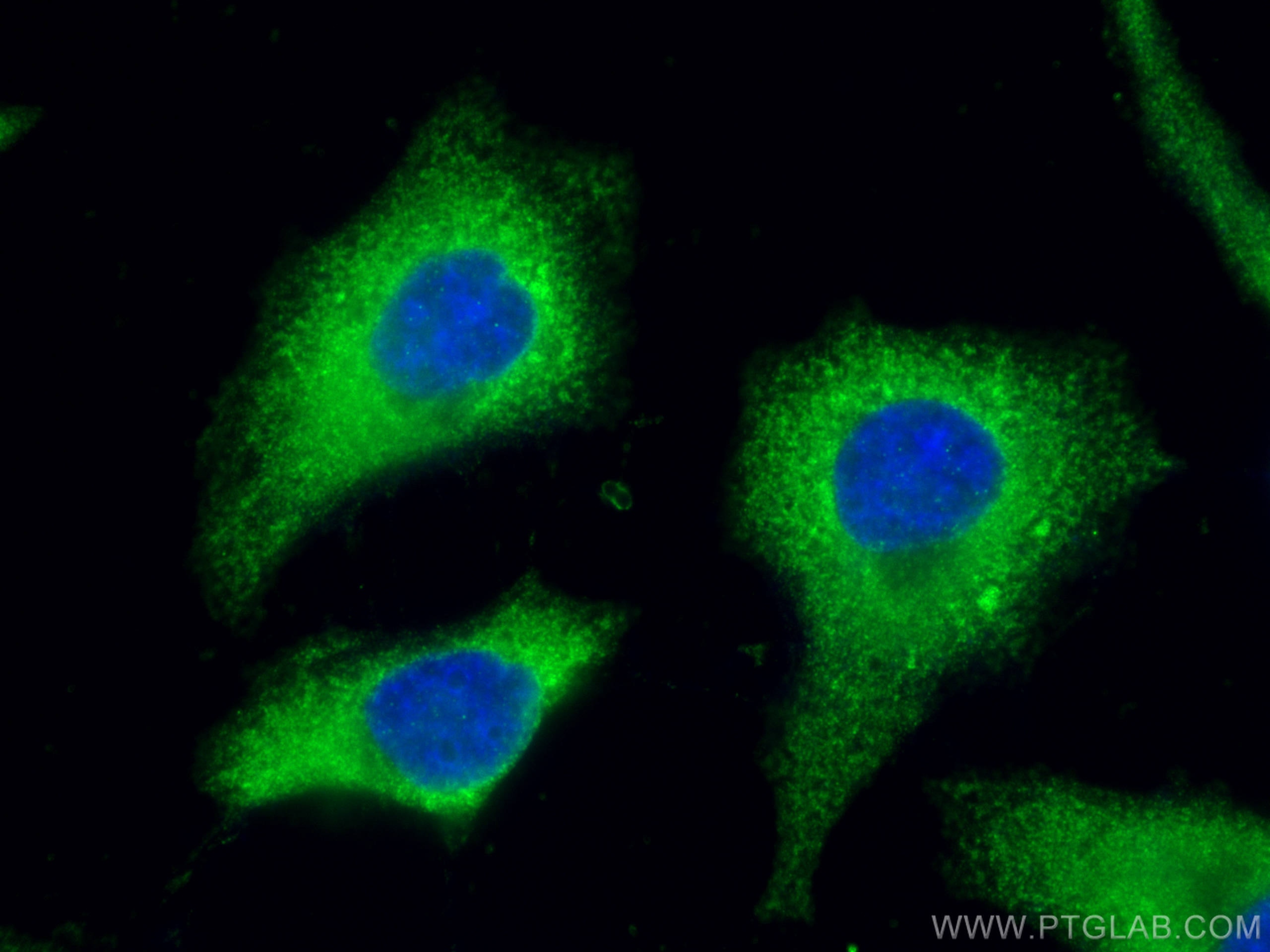 Immunofluorescence (IF) / fluorescent staining of HeLa cells using eRF3a/GSPT1 Polyclonal antibody (28130-1-AP)